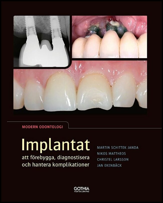 Larsson, Christel| Ekenbäck, Jan| Schittek Janda, Martin| Mattheos, Nikos | Implantat : Att förebygga, diagnostisera och...