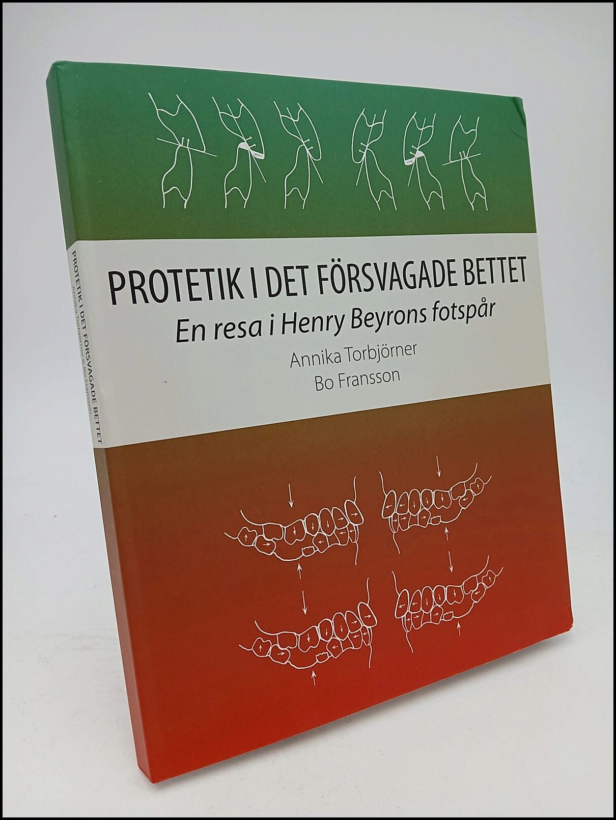 Torbjörner, Annika| Fransson, Bo | Protetik i det försvagade bettet : En resa i Henry Beyrons fotspår