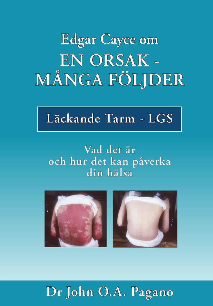 Pagano, John O. A. | Edgar Cayce om en orsak : Många följder