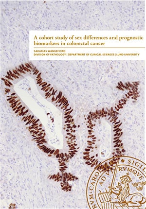 Wangefjord, Sakarias | A cohort study of sex differences and prognostic biomarkers in colerctal cancer