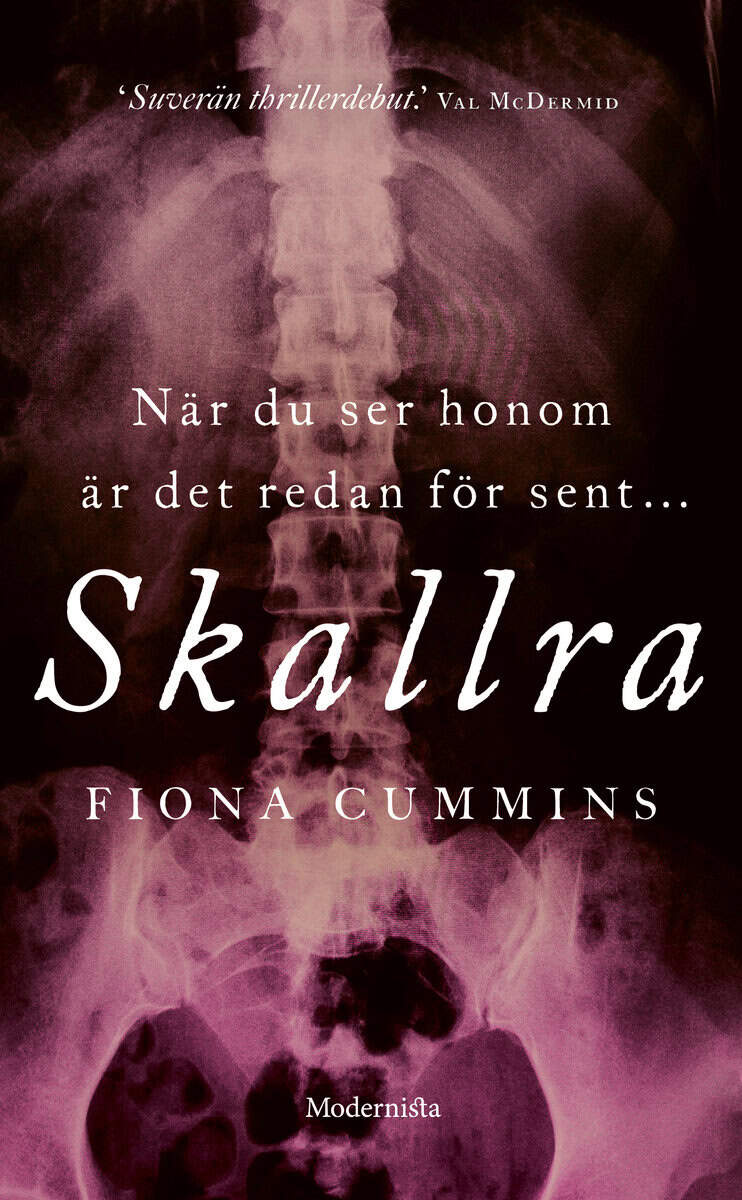 Cummins, Fiona | Skallra