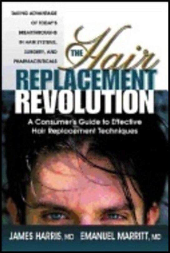 Emmanuel Marritt | Hair Replacement Revolution : Consumers Guide to Effective Hair Replacement Techniques