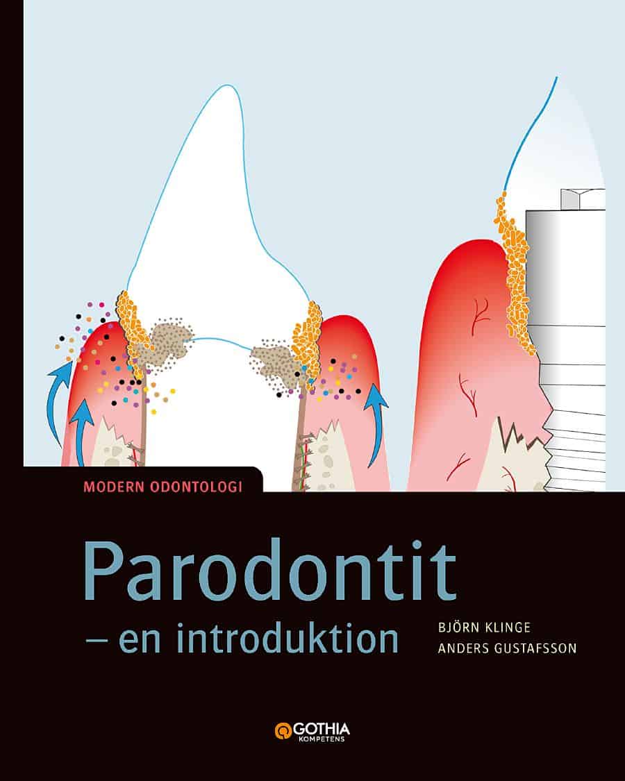 Gustafsson, Anders | Klinge, Björn | Parodontit : En introduktion