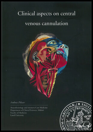 Pikwer, Andreas | Clinical aspects on central venous cannulation