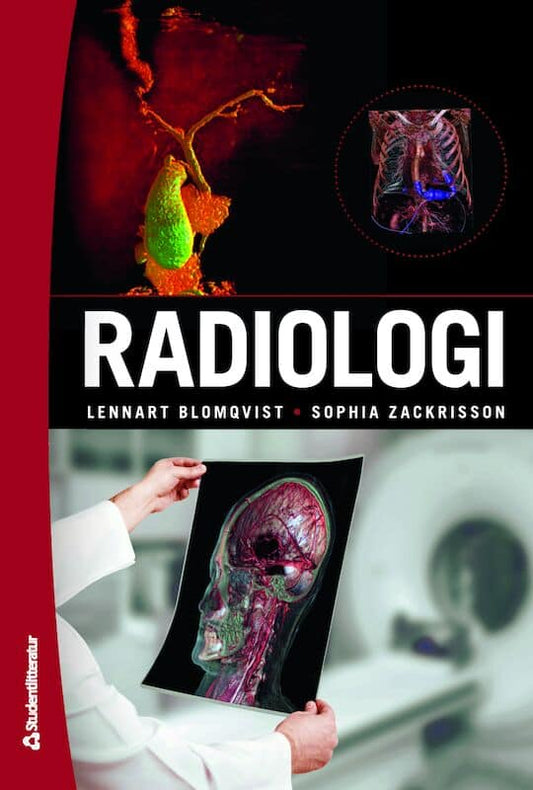 Blomqvist, Lennart | Zackrisson, Sophia | et al | Radiologi : (bok + digital produkt)