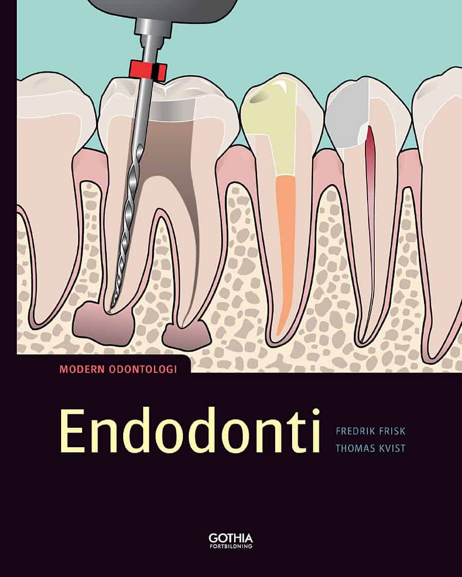 Frisk, Fredrik | Kvist, Thomas | Endodonti