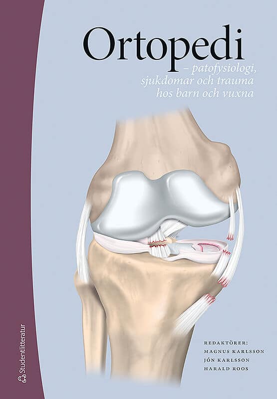 Karlsson, Magnus | Karlsson, Jón | Roos, Harald [red.] | Ortopedi : Patofysiologi, sjukdomar och trauma hos barn och vuxna