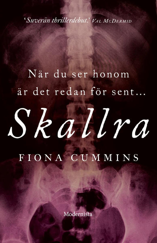 Cummins, Fiona | Skallra