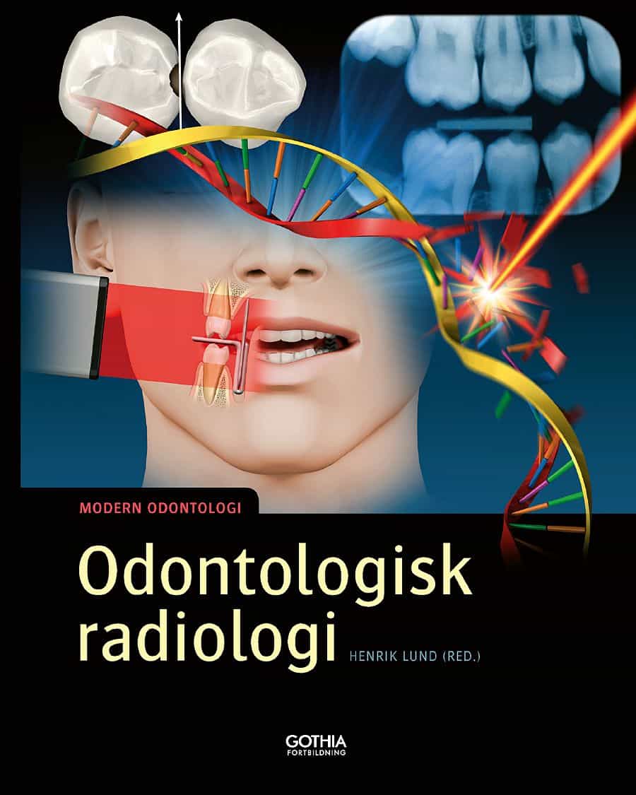 Lund, Henrik [red.] | Odontologisk radiologi