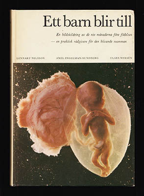 Nilsson, Lennart | Ingelman-Sundberg, Axel | Wirsén, Claes | Ett barn blir till : En bildskildring av de nio månaderna f...